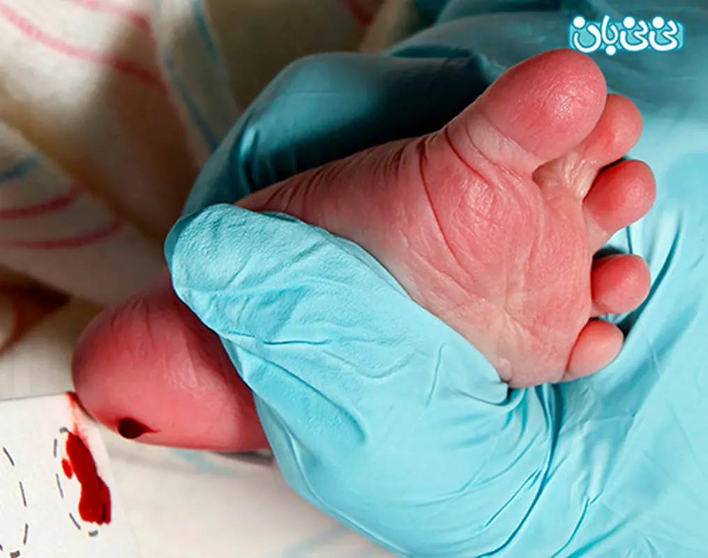 همه چیز درباره غربالگری نوزادان (2)