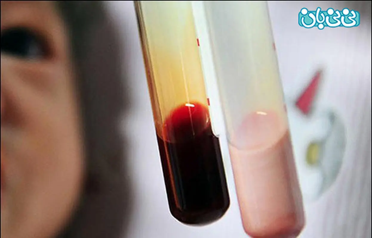 نوزادی با خون صورتی + تصویر