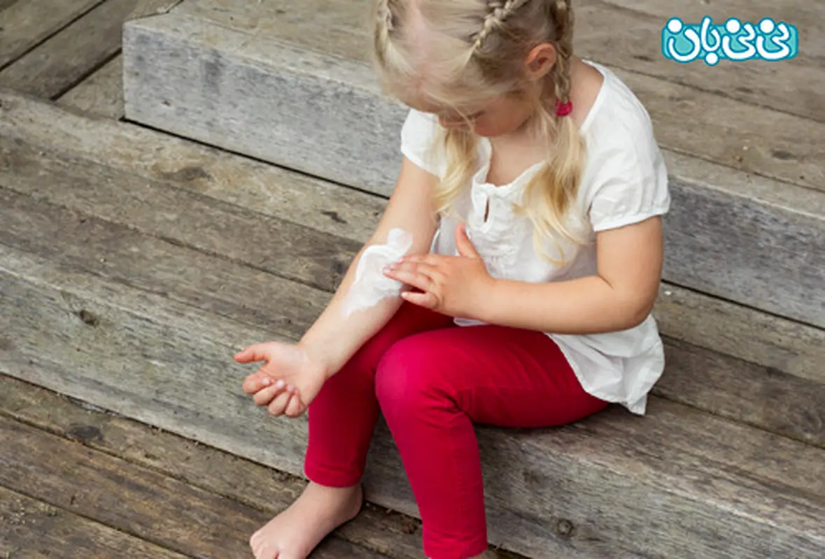 بیماری پوستی اگزما در کودکان، عوامل افزایش دهنده