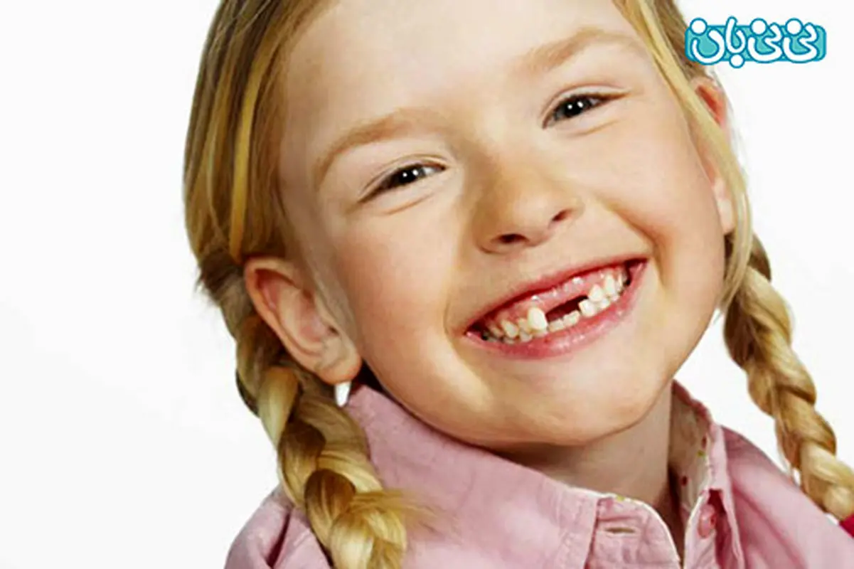علت نیفتادن دندان شیری