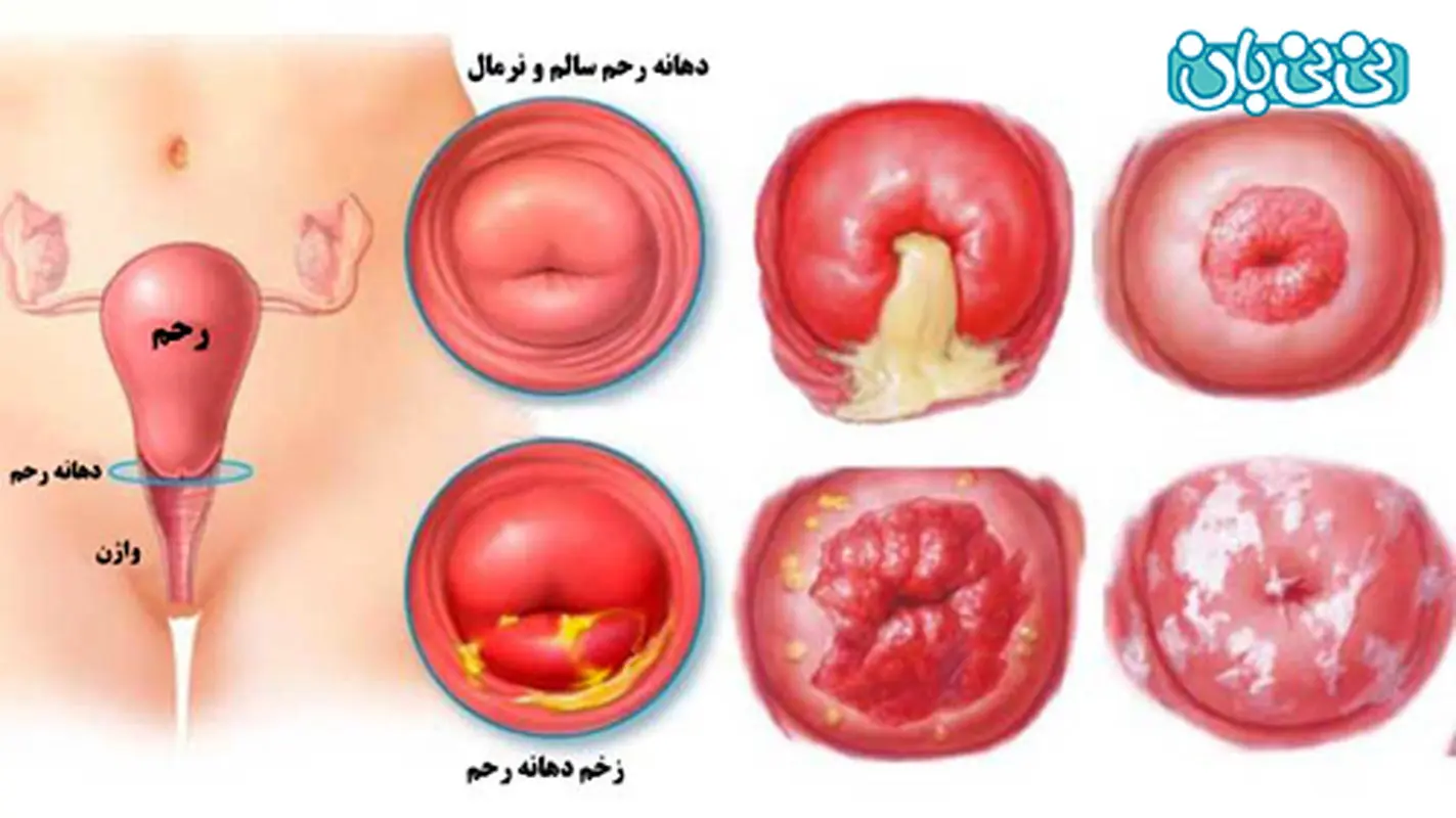 فریز کردن درد دارد؟