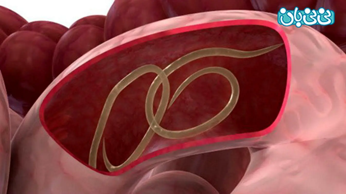افزایش احتمال بارداری، کرم آسکاریس موثره!