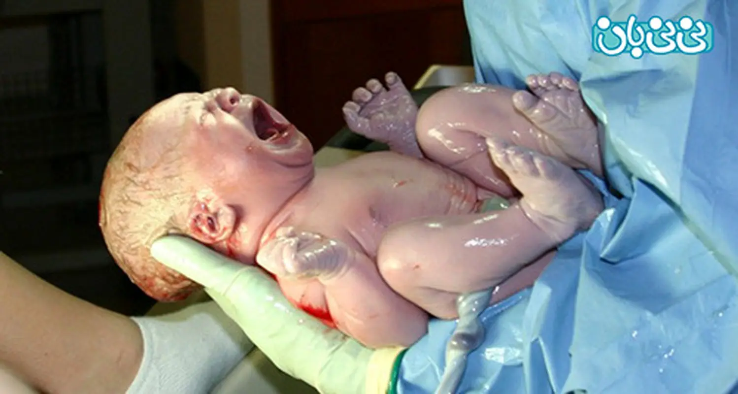 تولد نوزاد در منزل، توسط تکنیسین های اورژانس