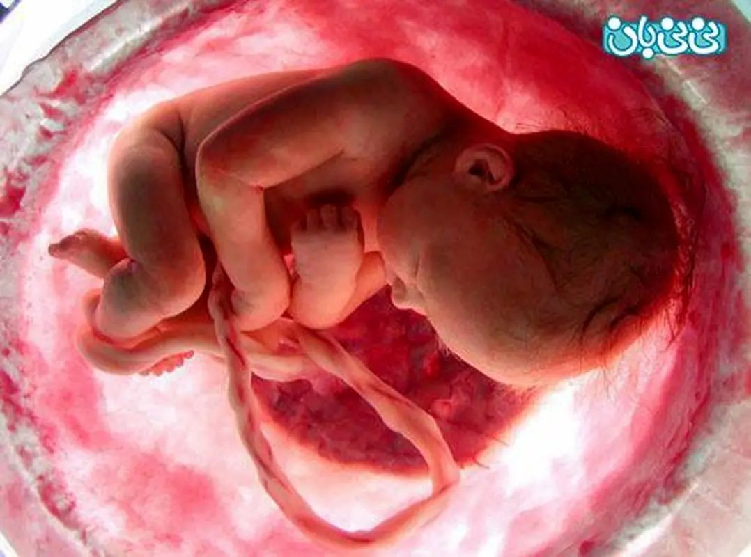 تغذیه سالم پس از انتقال جنین