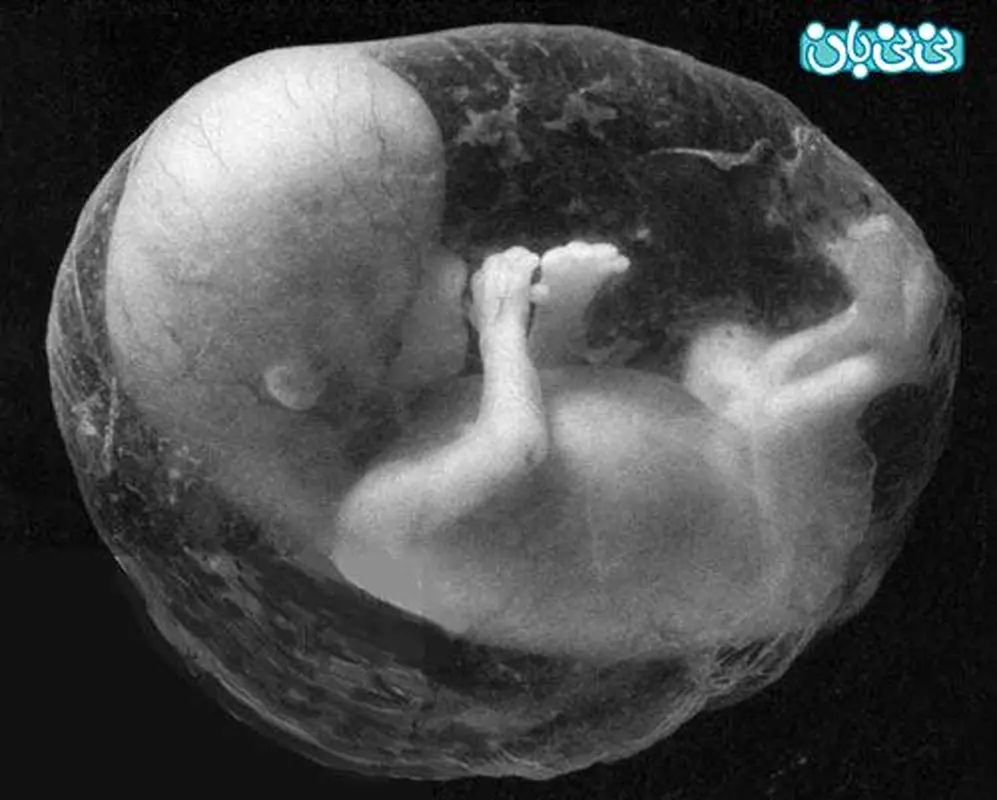 ناراحتی مادر روی جنین، تاثیر می‌گذارد؟