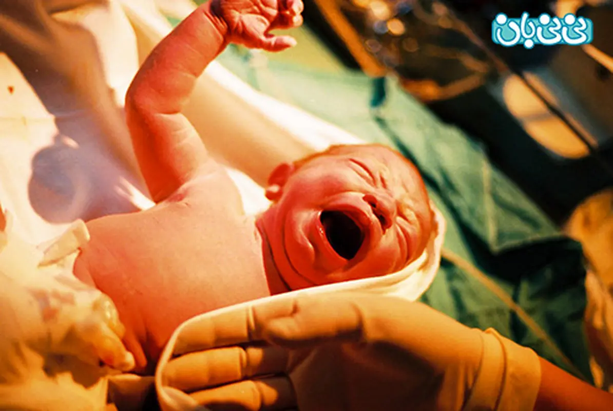 زایمان طبیعی یا سزارین، حق انتخاب با کیست؟!