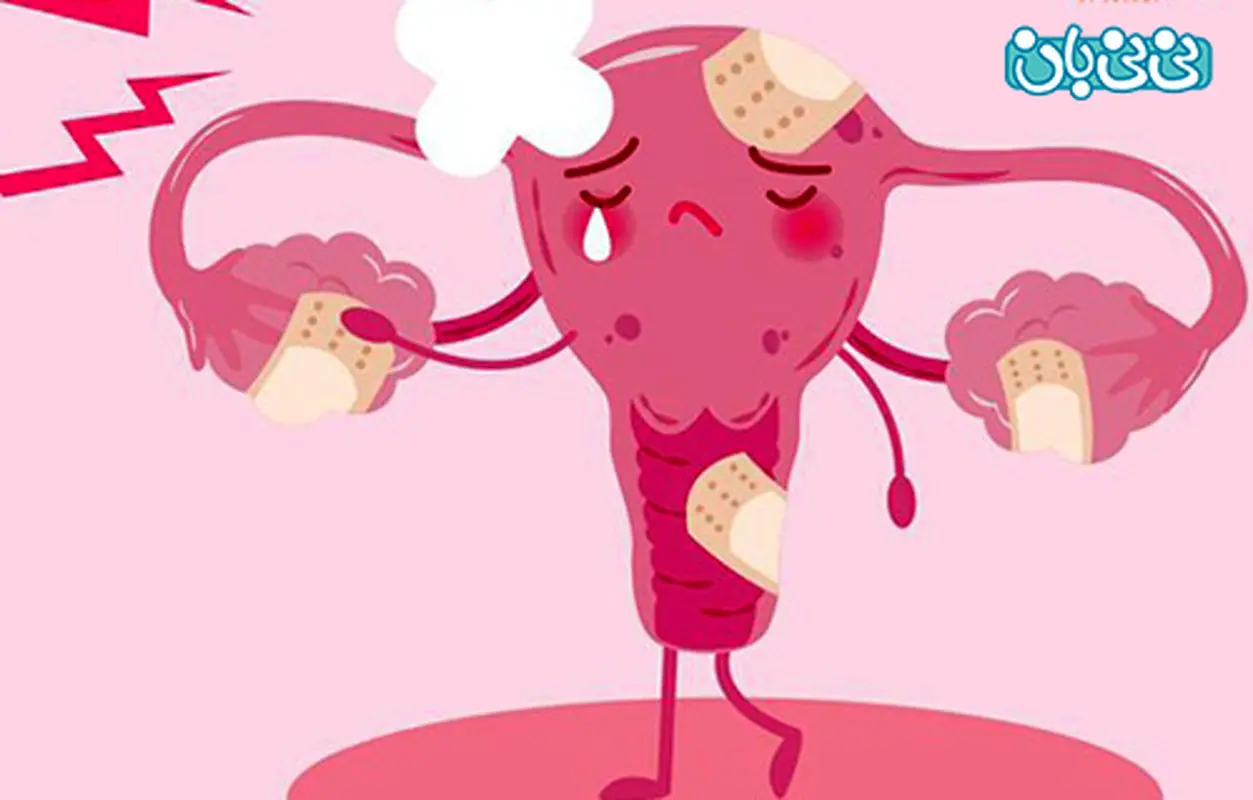 کیست هموراژیک چیست؟