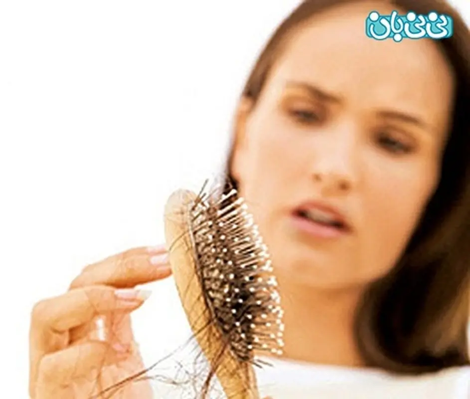 علت ریزش مو بعد زایمان، چند نکته