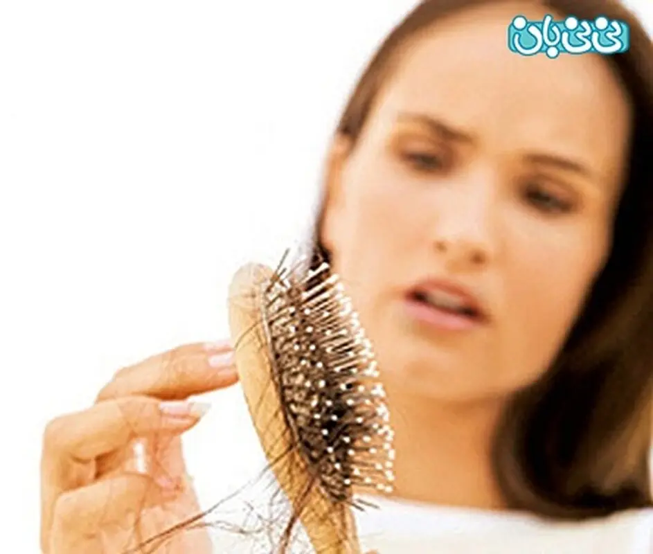 علت ریزش مو بعد زایمان، چند نکته