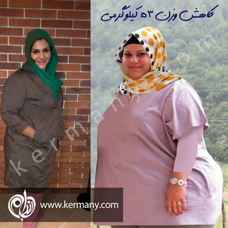 چگونگی کاهش وزن، بانوان به فکر باشید