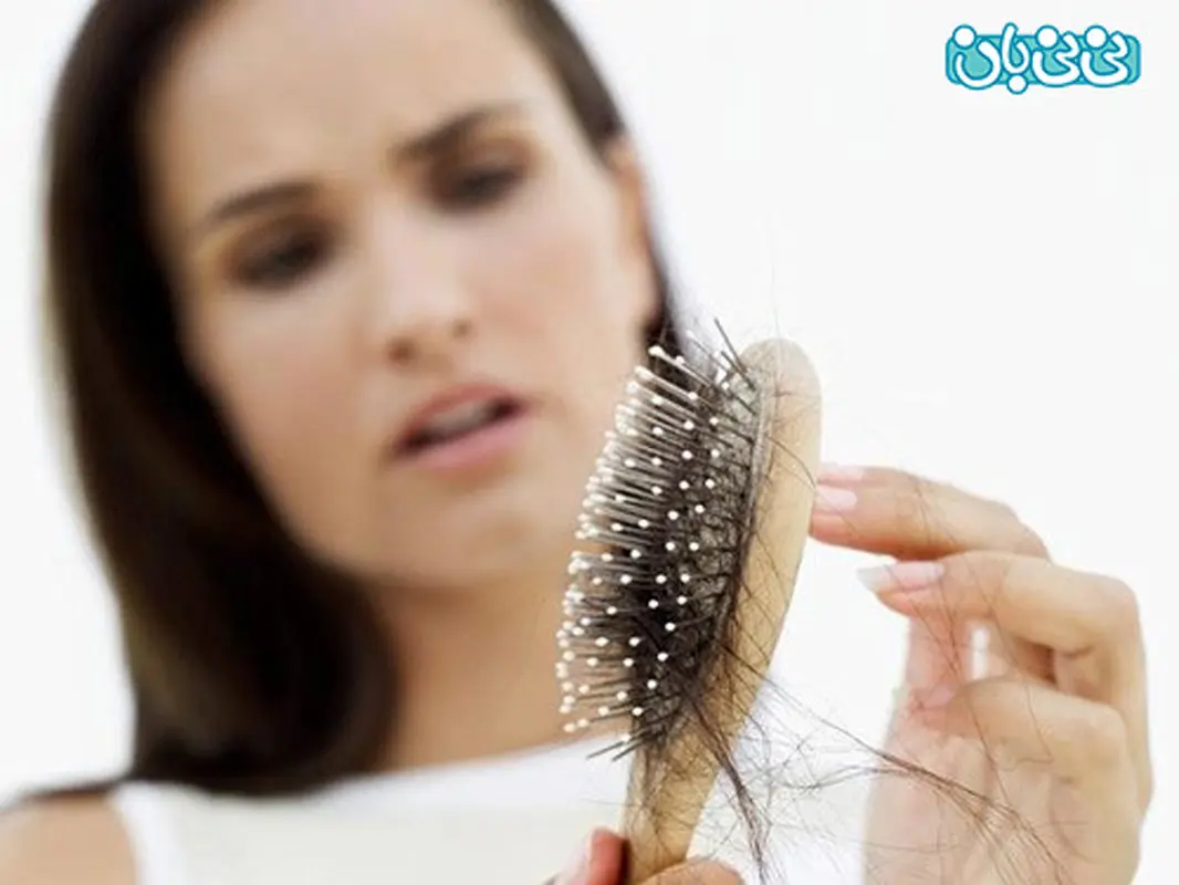 ریزش مو زنان، ارتباطش با چاقی چیست؟
