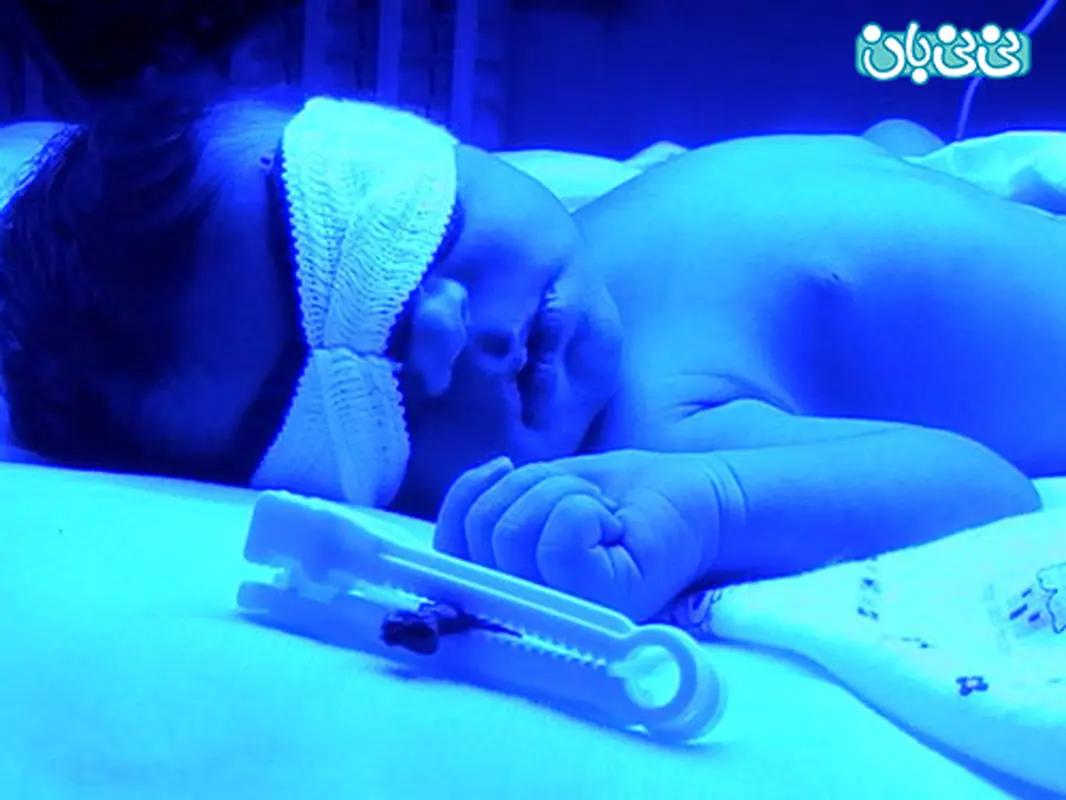 مشکل زردی در نوزادان، بیشتر بدانید