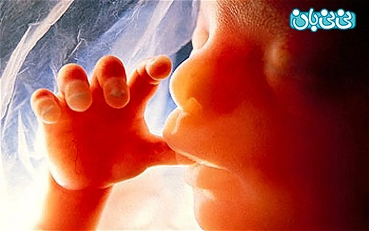 افزایش سقط جنین، آماری عجیب