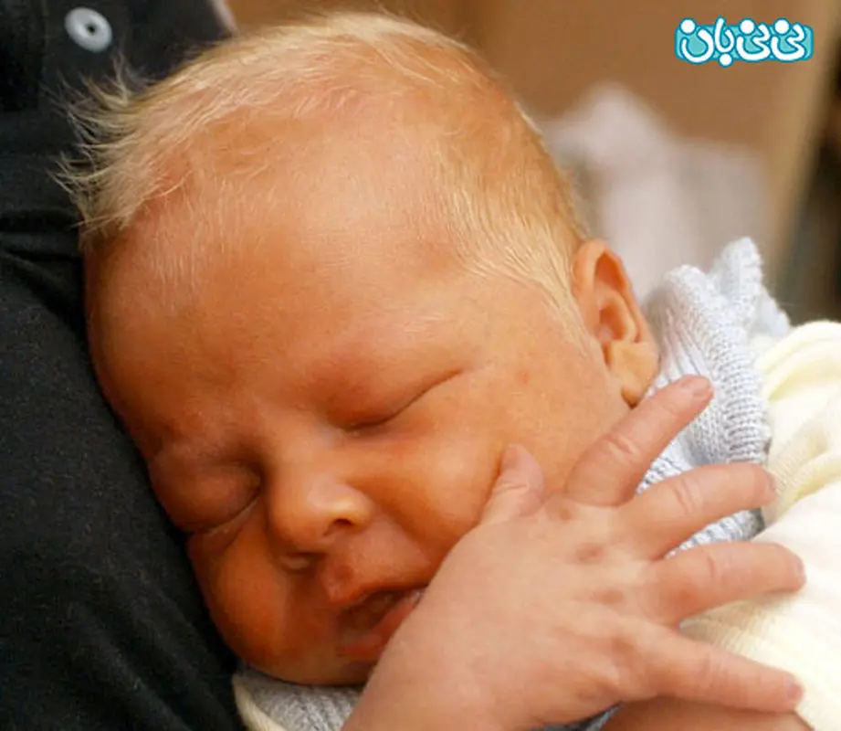 عفونت خون در نوزادان، اهمیت روش درمان!