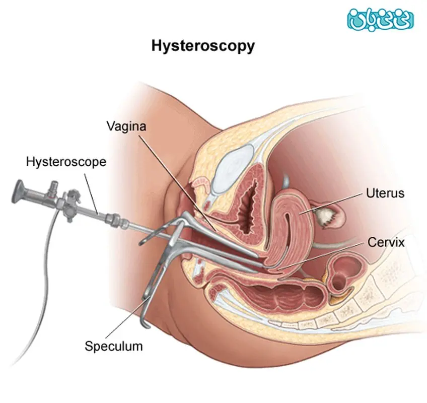 اقدام به بارداری، چه مدت بعد از عکس رنگی؟