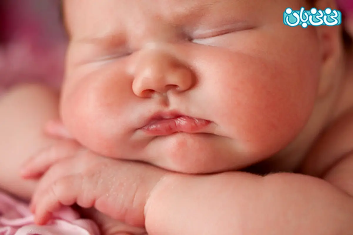 اضافه وزن در دختران فرزند اول یک خانواده بیشتر است