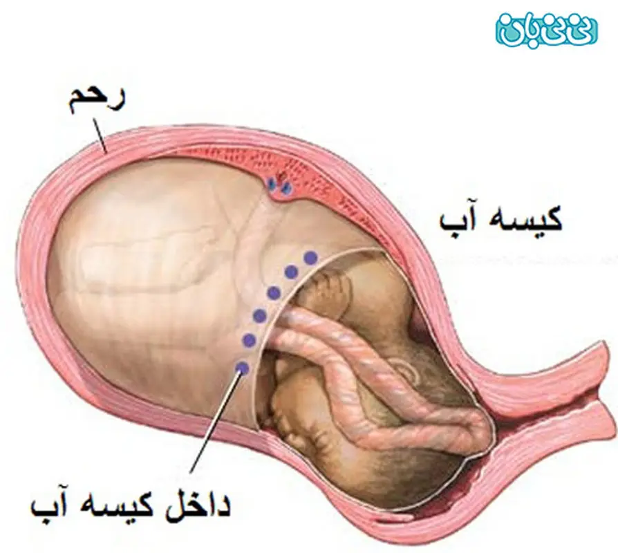 مقدار مایع آمنیوتیک چقدر باید باشد؟