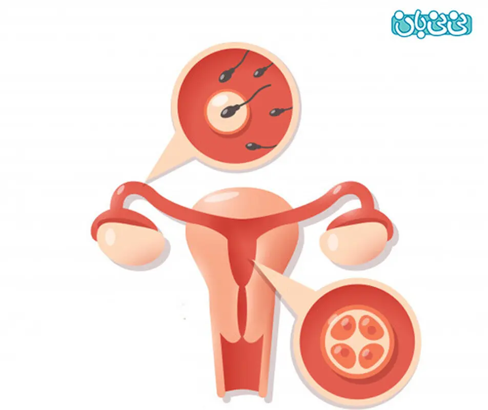 داروی ضدبارداری اورژانسی را چگونه مصرف کنیم؟