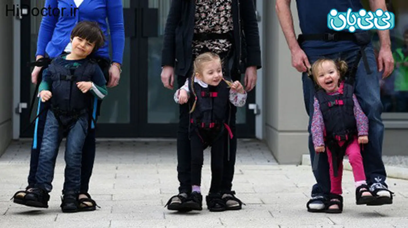 لنگیدن کودک نوپا، چطور می شود درمان کرد؟