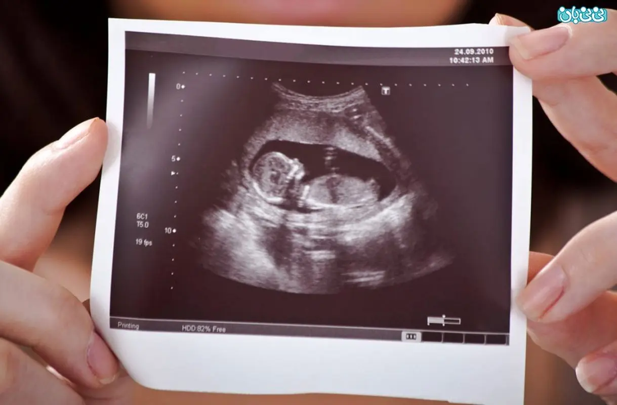 برای غربالگری سه ماهه اول ناشتا باشم؟