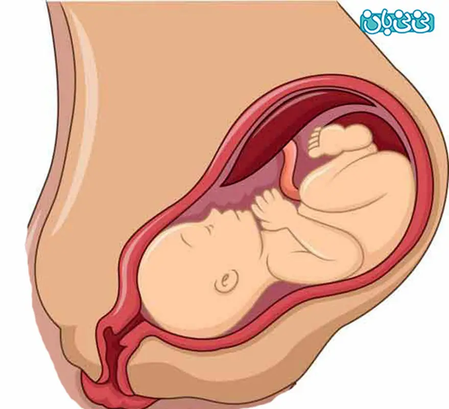 از وضعیت جفت خلفی چه می دانید؟