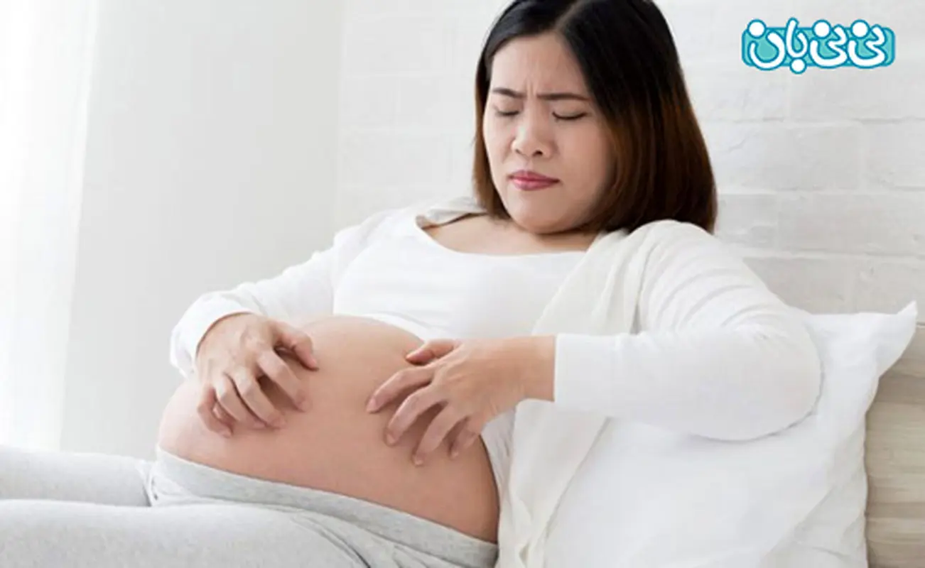 کلستاز بارداری چیست و چه درمانی دارد؟