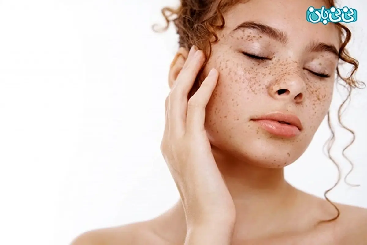 کک و مک پوست صورت، پانزده راه حل برای زنان