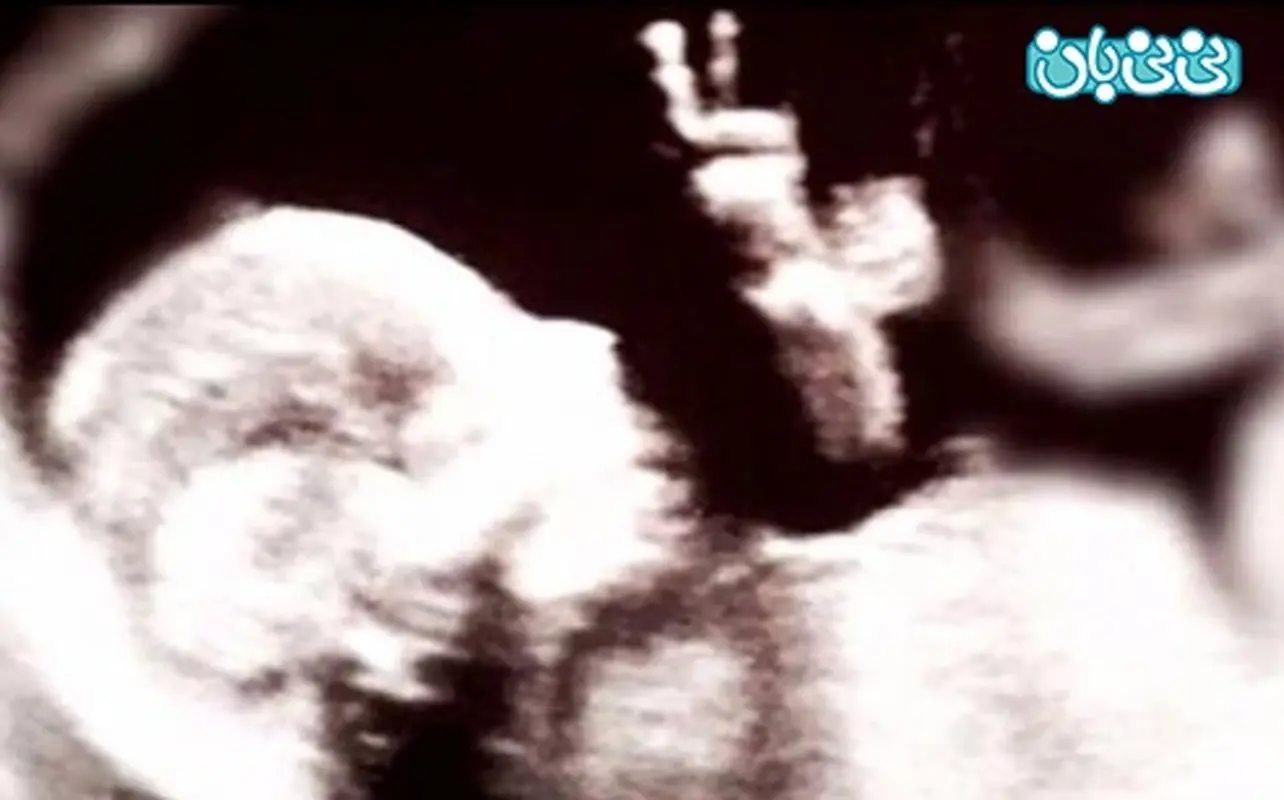 حرکات جنین در سونوگرافی، تصویری عجیب