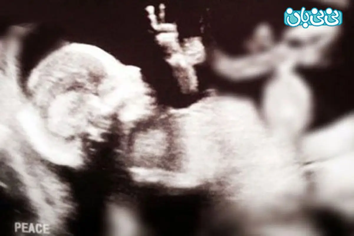 حرکت جنین در سونوگرافی، تصویر باورنکردنی