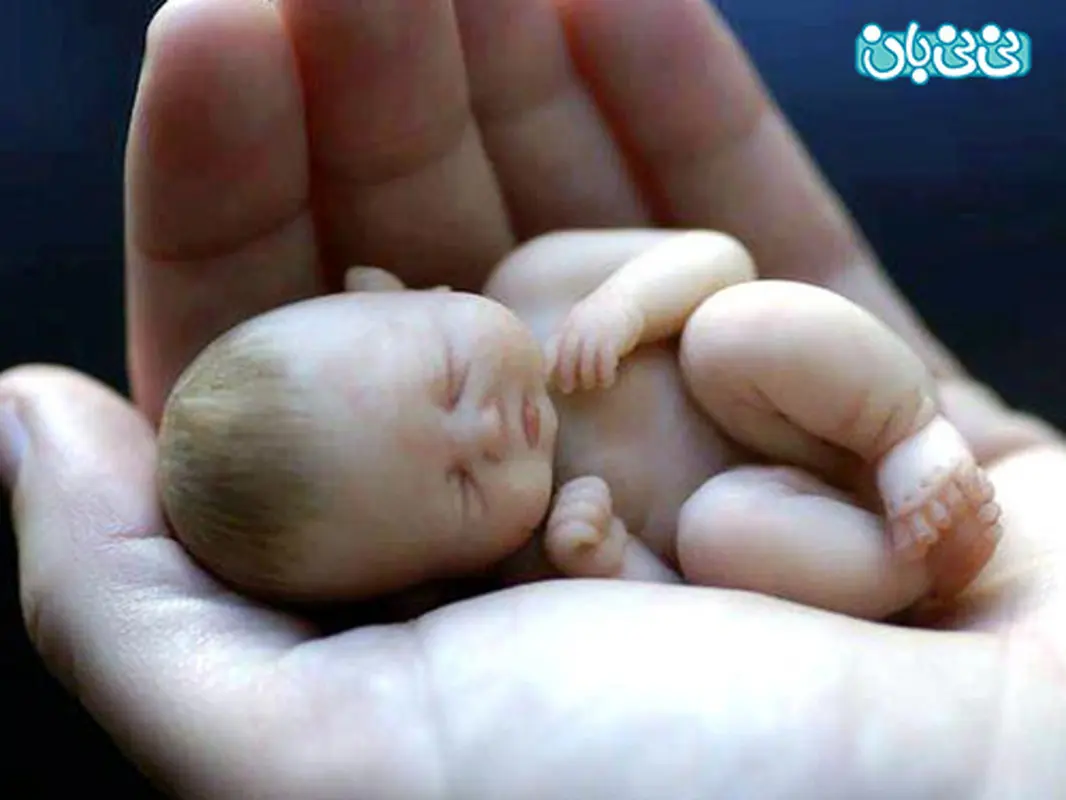 تغذیه بعد از سقط جنین، چه بخورم؟