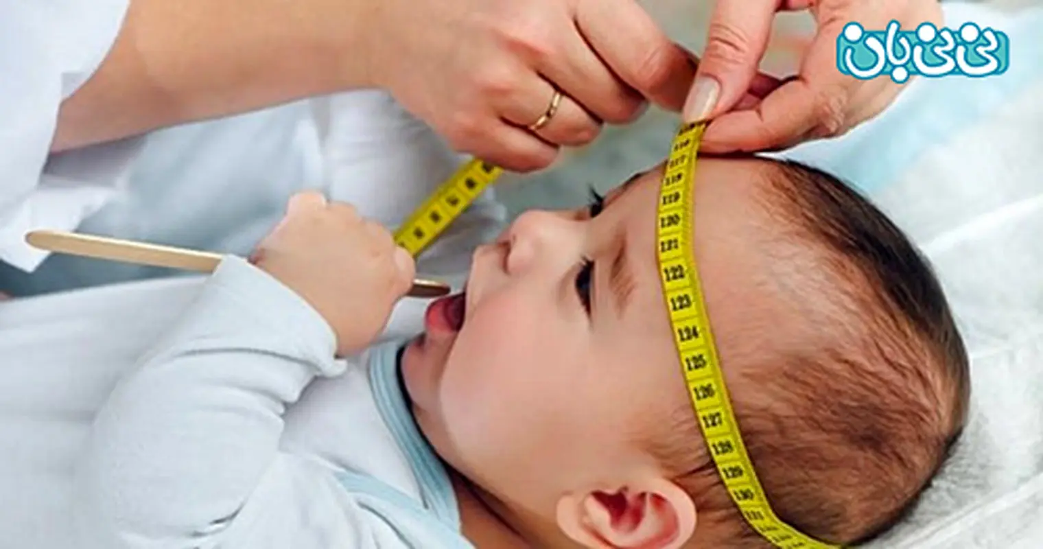 کوچک بودن دور سر نوزاد، درمان