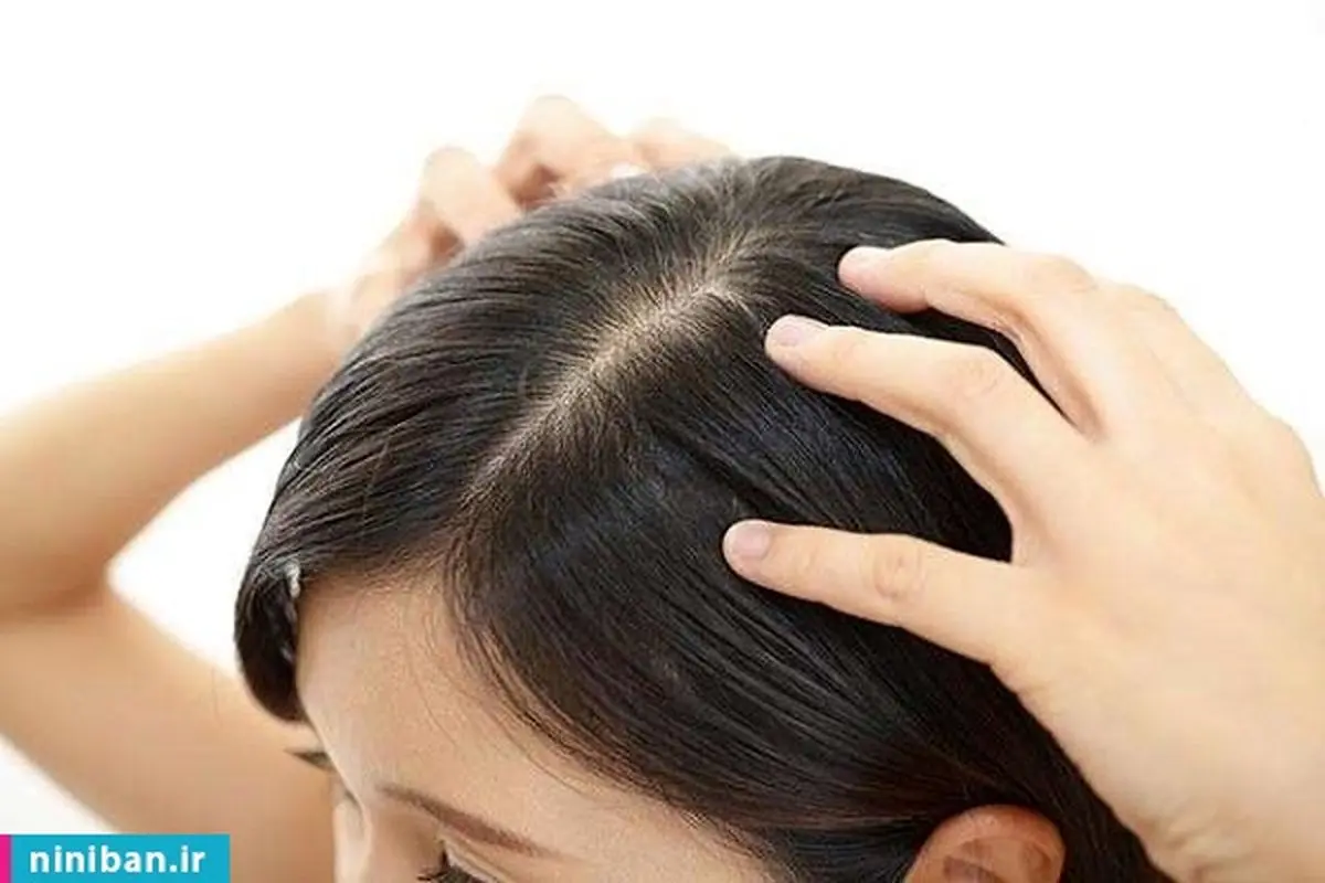 قرص ضد بارداری، برای درمان ریزش مو؟