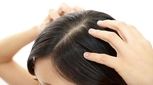 قرص ضد بارداری، برای درمان ریزش مو؟