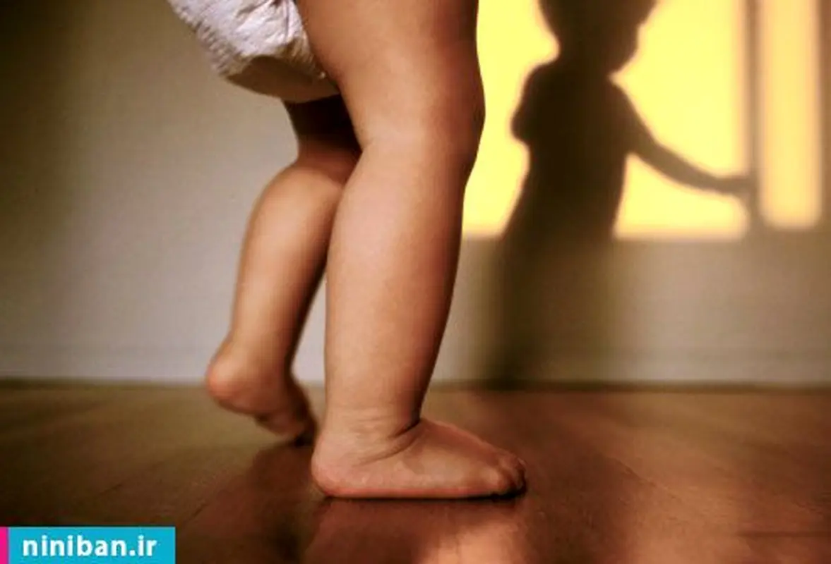 زود راه افتادن کودک، نشانه چیست؟