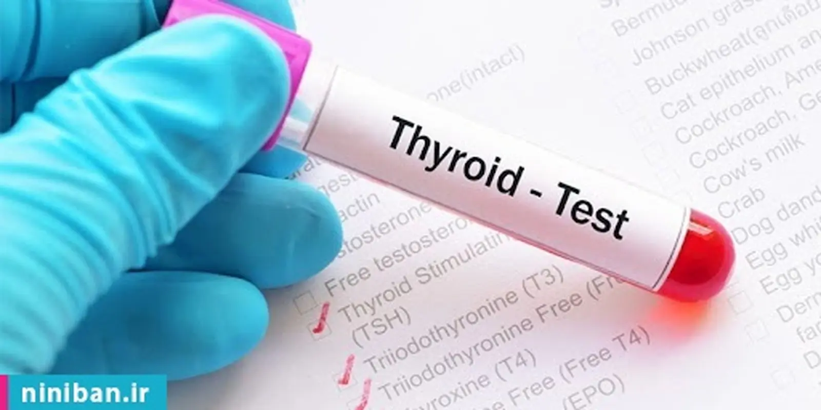 آزمایش تیروئید، در پریود اشکالی دارد؟
