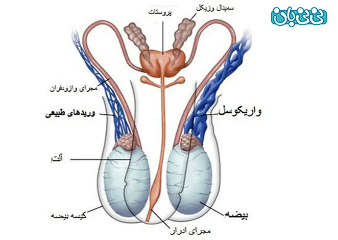 زمان نزدیکی بعد از عمل واریکوسل