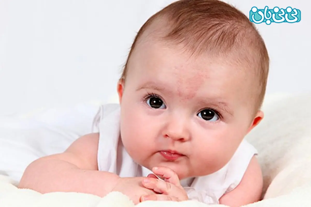 خال مادرزادی در نوزادان، کدامها خطرناکند؟