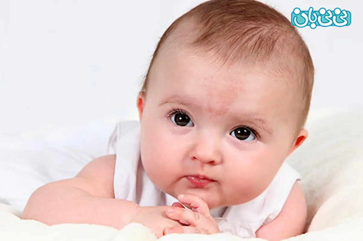 خال مادرزادی در نوزادان، کدامها خطرناکند؟