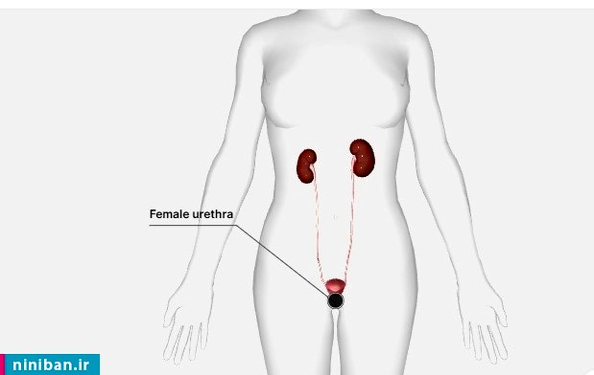 سوراخ ادرار و واژن، ممکنه یکسان باشند؟