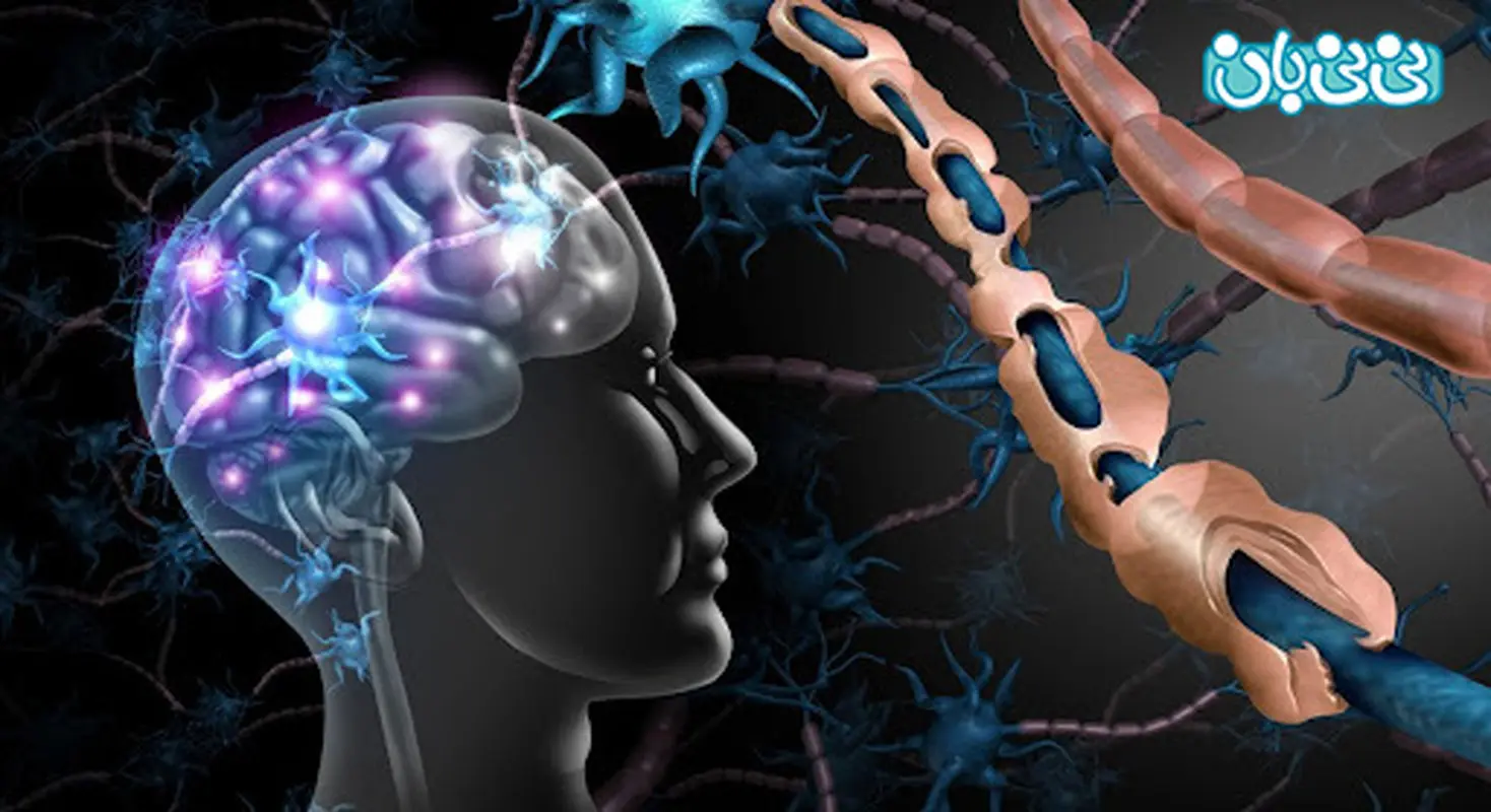 علائم اولیه بیماری ام اس، کدام زنان در خطرند؟