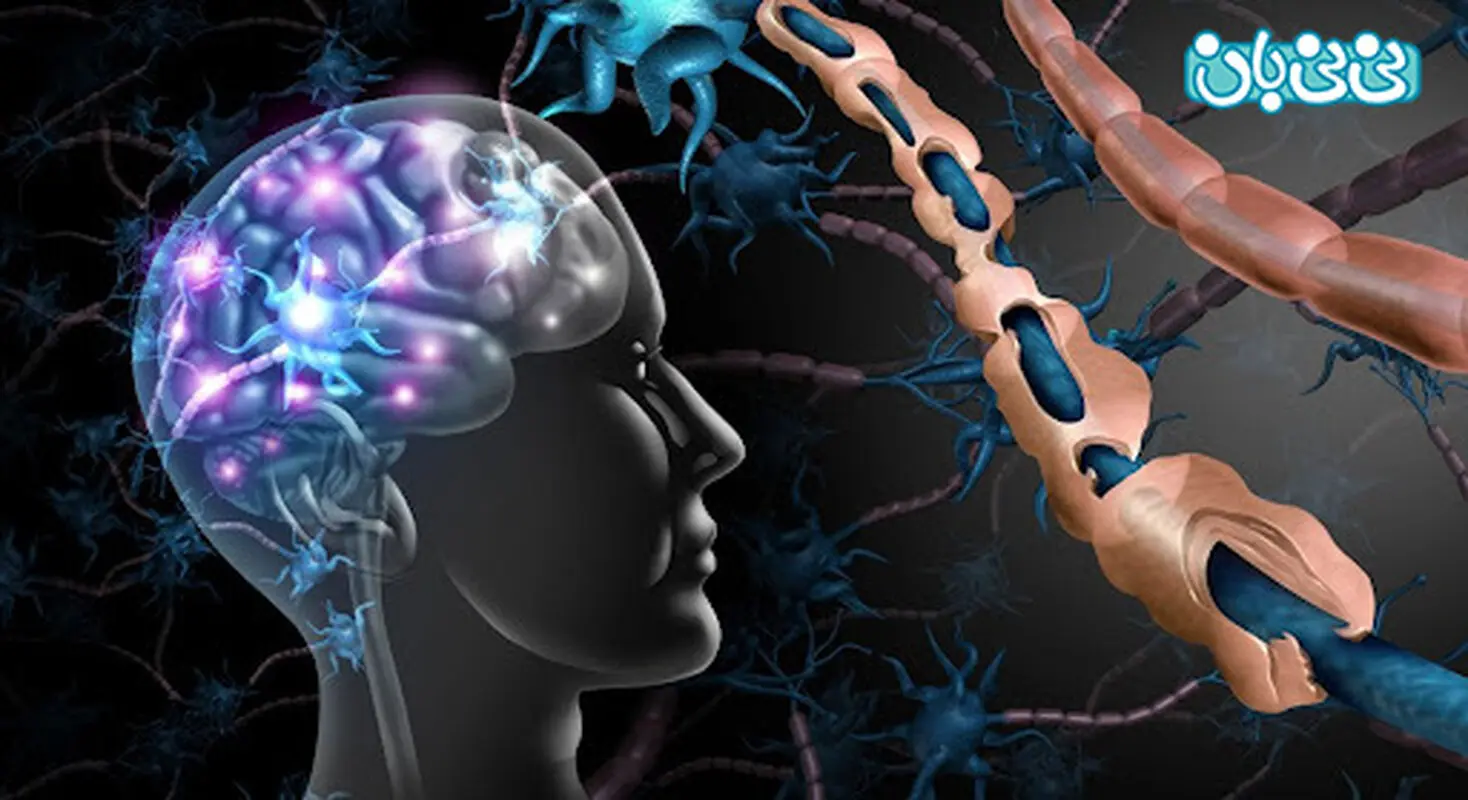 علائم اولیه بیماری ام اس، کدام زنان در خطرند؟