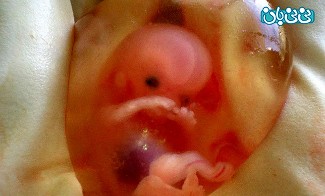 تشکیل ساک حاملگی، در کدام هفته بارداری؟