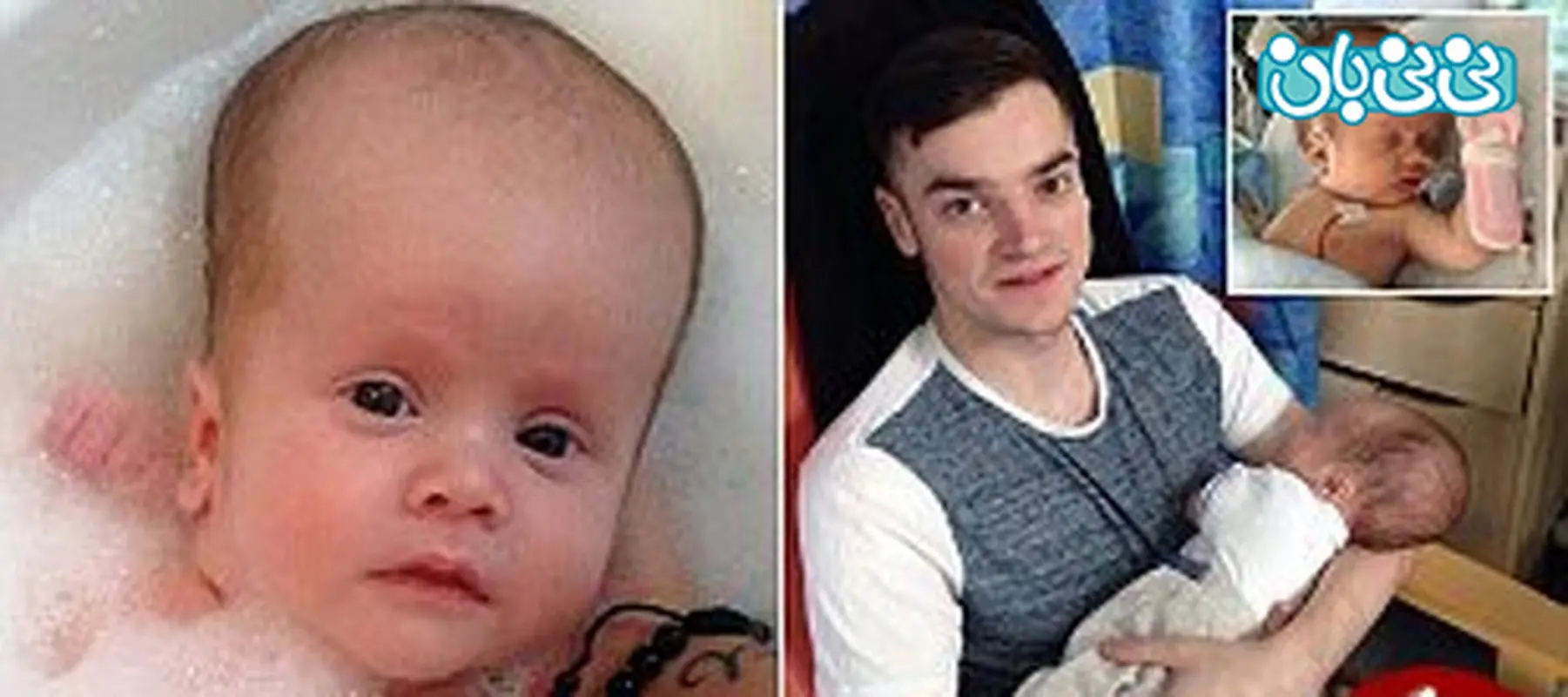 بیماری مغزی در نوزادان، اچ پی ای چگونه است؟