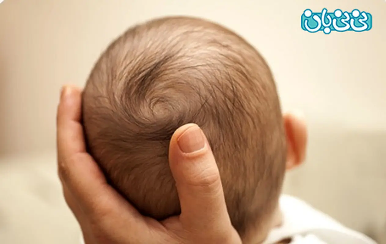 سر نوزاد تا چند ماهگی شکل میگیرد؟