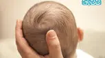سر نوزاد تا چند ماهگی شکل میگیرد؟
