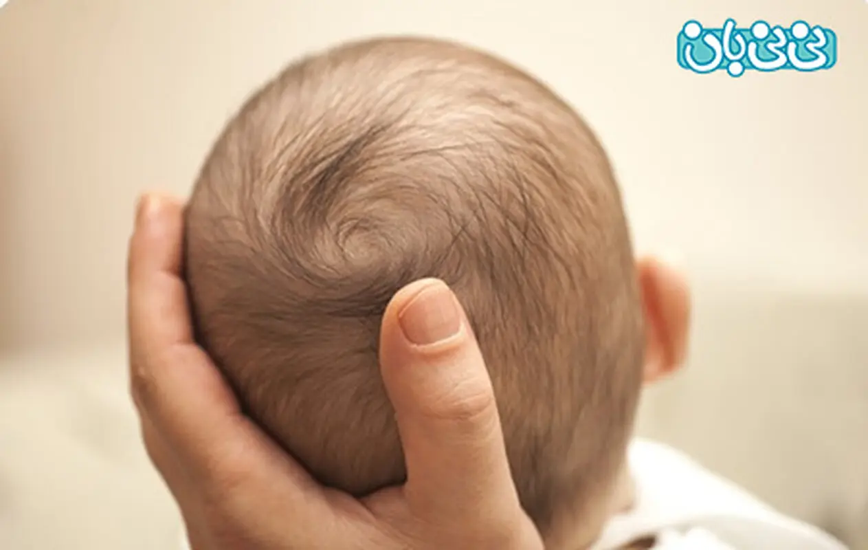 سر نوزاد تا چند ماهگی شکل میگیرد؟