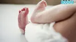 سوختگی ناشی از اسهال، چه کنم؟