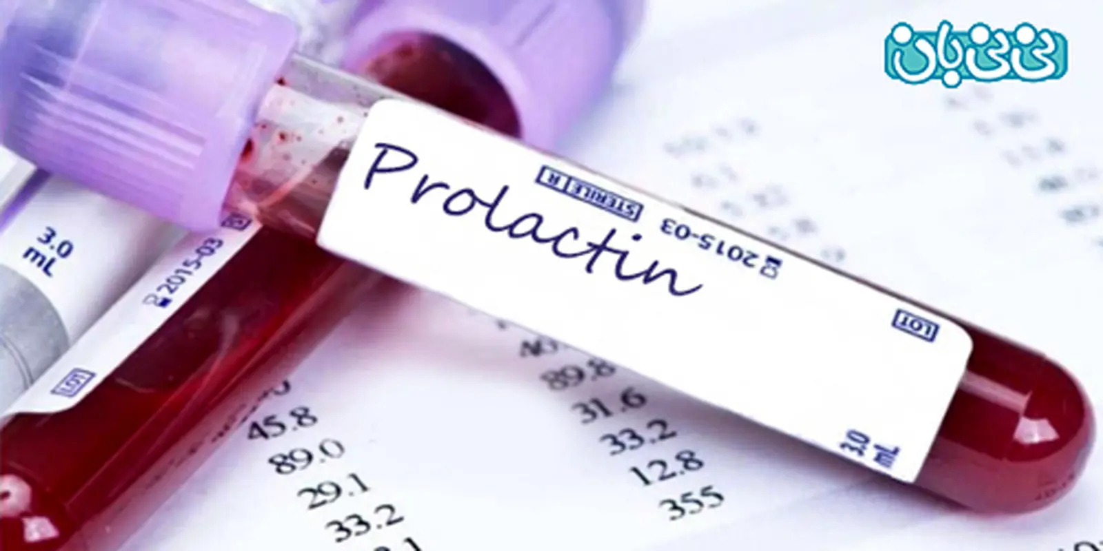 بالا بودن پرولاکتین خون نشانه چیست؟