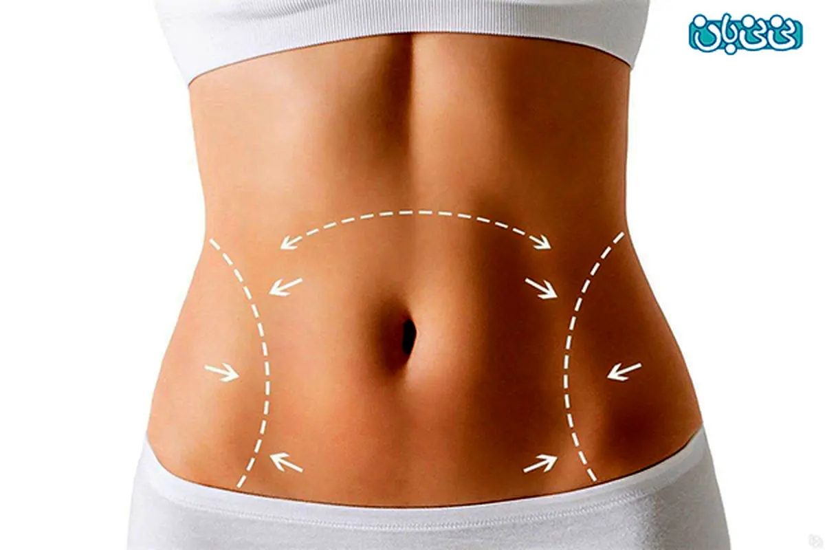 کاهش وزن بعد از زایمان، می‌توان عمل کرد؟