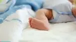 شرایط ختنه نوزادان، همه چیز را بدانید!